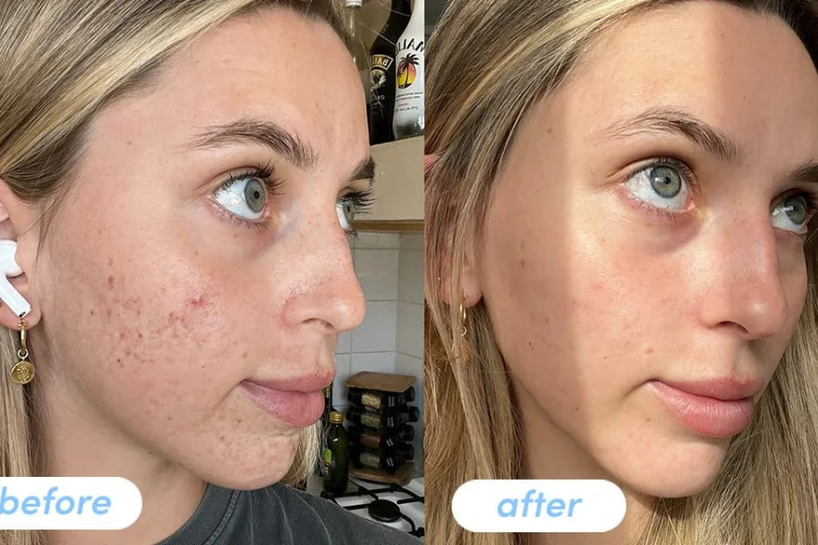 How Long Do Peptides Take to Work